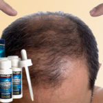Minoxidil Kirkland для роста волос и бороды