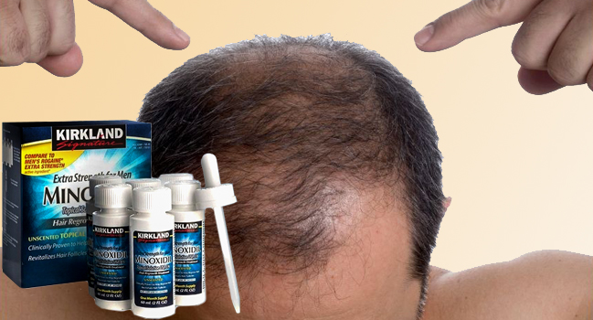 Minoxidil Kirkland для роста волос и бороды